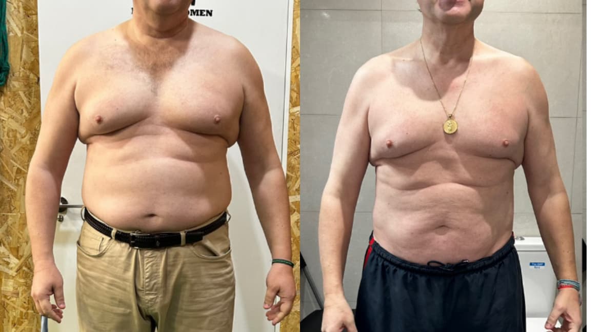Transformación real de cliente 5 — antes y después